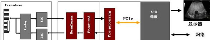  FPGA在超声领域的应用