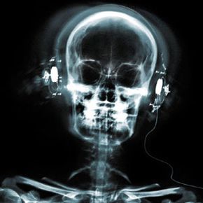骨听器通过颅骨中的骨骼而不是通过外耳和鼓膜传输声音。
